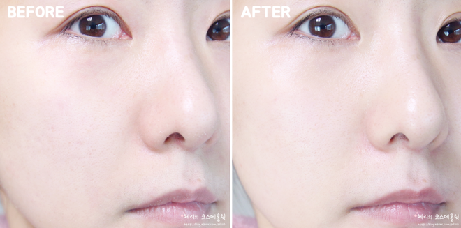 Tẩy da chết hóa học đang là xu hướng làm đẹp thời gian gần đây