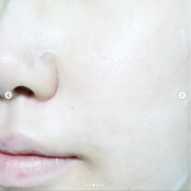 Tẩy da chết hóa học đang là xu hướng làm đẹp thời gian gần đây